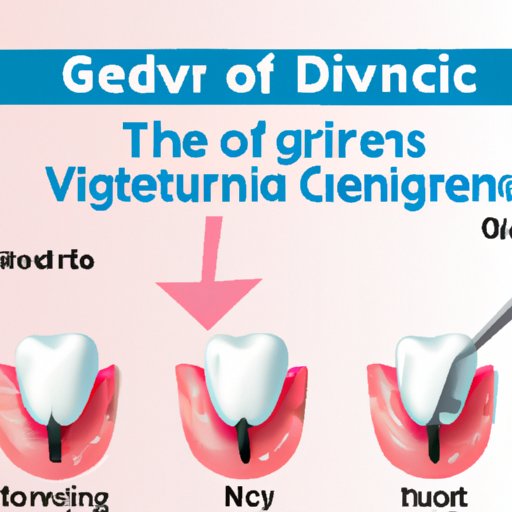 IV. The Ultimate Guide to Fixing Receding Gums with Dental Procedures